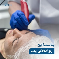 پلاسما ایج